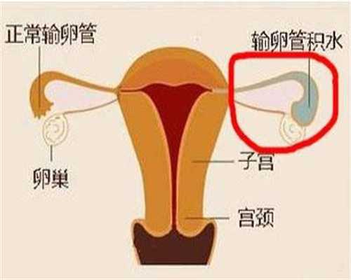 人工受孕对女人伤害：精子质量不好能治好吗