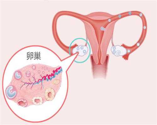 上海代生孩子包男孩_总结发现：得卵巢癌的女性