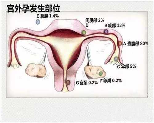广州高鹰助孕费用_泰国有几家代孕公司_因为对试