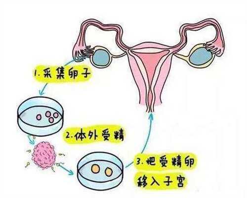 宁波代孕产子的过程和方式：1610181205914