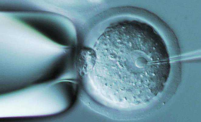 长春卵巢早衰供卵群 试管婴儿长春哪个医院比较好? ‘胎囊3个数据1288看男女’
